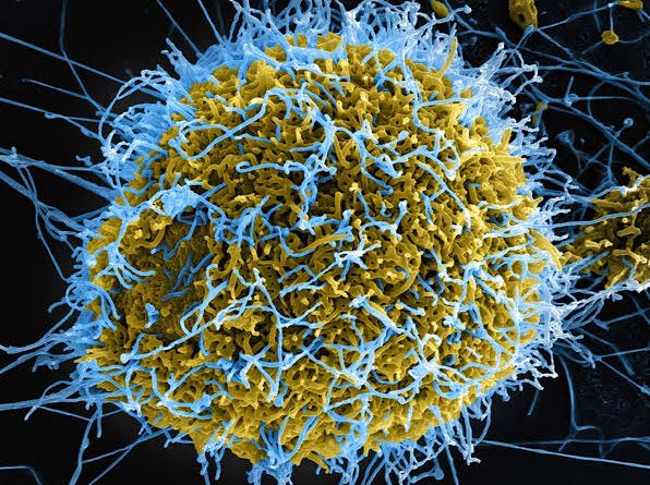Ebola: NCDC warns of importation risk after Kenya confirms first case